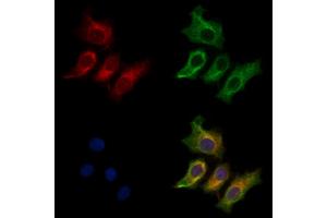 ABIN7094372 and ABIN7098419 staining HepG2 cells by IF/ICC. (CRYM anticorps  (Internal Region))