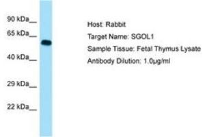 Image no. 1 for anti-Shugoshin 1 (SGOL1) (AA 395-444) antibody (ABIN6749951) (Shugoshin anticorps  (AA 395-444))