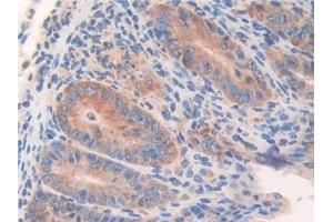 Detection of WARS in Mouse Small intestine Tissue using Polyclonal Antibody to Tryptophanyl tRNA Synthetase (WARS)