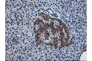 Image no. 3 for anti-Pyridoxal Kinase (PDXK) antibody (ABIN1500145)