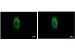 ICC/IF Image ZDHHC13 antibody [C3], C-term detects ZDHHC13 protein at cytoplasm by immunofluorescent analysis.