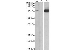 Western Blotting (WB) image for anti-Nuclear Receptor Subfamily 2, Group C, Member 2 (NR2C2) (Internal Region) antibody (ABIN2466352) (TR4 anticorps  (Internal Region))