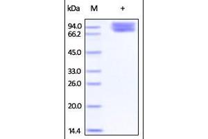 Cynomolgus B7-2, Fc Tag on SDS-PAGE under reducing (R) condition. (CD86 Protein (CD86) (AA 19-240) (Fc Tag))