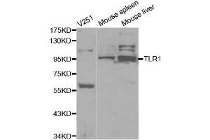 Western blot analysis of extracts of various cell lines, using TLR1 antibody. (TLR1 anticorps  (AA 30-290))