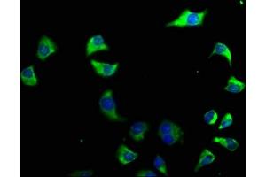 Immunofluorescence staining of A549 cells with ABIN7140223 at 1:50, counter-stained with DAPI.