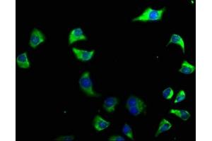 Immunofluorescence staining of A549 cells with ABIN7140223 at 1:50, counter-stained with DAPI. (CACNG6 anticorps  (AA 22-39))