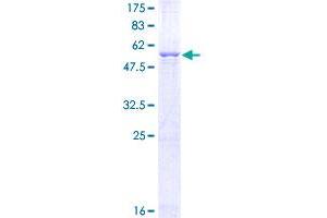 Image no. 1 for GTP Cyclohydrolase 1 (GCH1) (AA 1-250) protein (GST tag) (ABIN1354910)