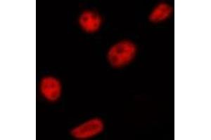ABIN6275393 staining HepG2 by IF/ICC. (PRPF18 anticorps  (Internal Region))