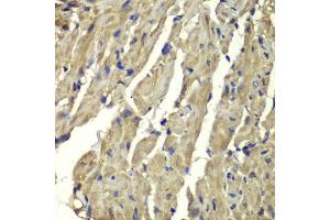 Immunohistochemistry of paraffin-embedded mouse heart using FXN antibody. (Frataxin anticorps)