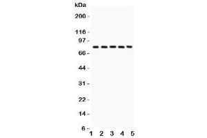 Western blot testing of Calpain antibody and Lane 1:  rat lung (Calpain anticorps  (Catalytic Subunit))