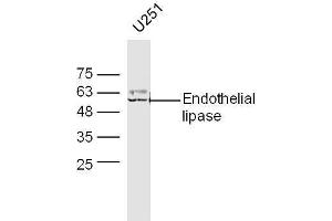 U251 lysates probed with Anti-Endothelial lipase Polyclonal Antibody, Unconjugated  at 1:5000 90min in 37˚C. (LIPG anticorps  (AA 301-400))