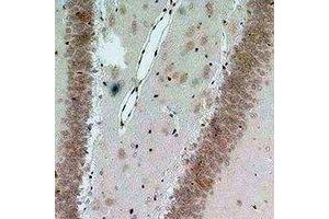 Immunohistochemical analysis of Bestrophin-2 staining in rat brain formalin fixed paraffin embedded tissue section. (Bestrophin 2 anticorps)