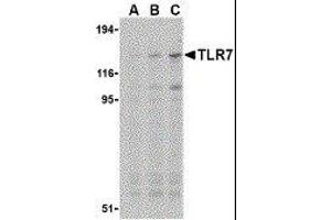 Western Blotting (WB) image for anti-Toll-Like Receptor 7 (TLR7) antibody (ABIN2476854)