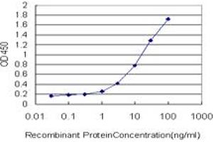 Detection limit for recombinant GST tagged LAMC1 is approximately 0.