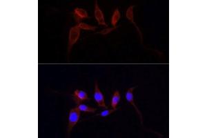 Immunofluorescence analysis of PC12 cells using YAP1 antibody.