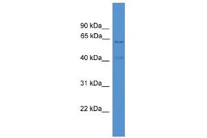 WB Suggested Anti-ACADVL Antibody Titration: 0. (ACADVL anticorps  (C-Term))