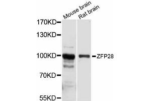 Western blot analysis of extracts of various cell lines, using ZFP28 antibody (ABIN6293840) at 1:1000 dilution.