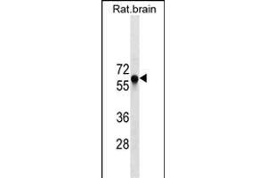 GAD2 Antibody ABIN1539900 western blot analysis in rat brain tissue lysates (35 μg/lane). (GAD65 anticorps  (AA 109-138))