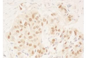 Immunohistochemistry (IHC) image for anti-DDB1 and CUL4 Associated Factor 6 (DCAF6) (AA 600-650) antibody (ABIN7453611)