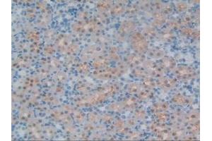 Detection of CSPG5 in Rat Kidney Tissue using Polyclonal Antibody to Chondroitin Sulfate Proteoglycan 5 (CSPG5)