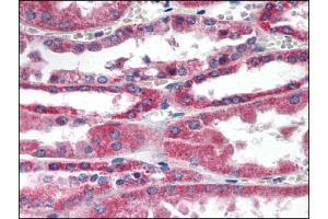 Image no. 1 for anti-Retinol Dehydrogenase 11 (All-Trans/9-Cis/11-Cis) (RDH11) (AA 1-7), (C-Term), (N-Term) antibody (ABIN372579)