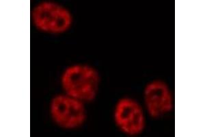 ABIN6269226 staining PC-3 cells by IF/ICC.