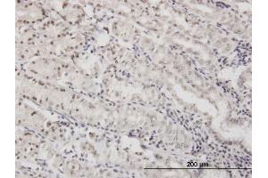 Immunoperoxidase of monoclonal antibody to DLX5 on formalin-fixed paraffin-embedded human stomach.