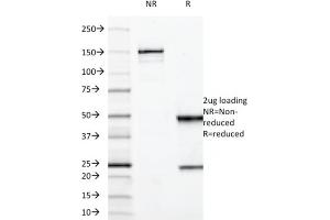 SDS-PAGE Analysis Purified MUC3 Mouse Monoclonal Antibody (M3. (MUC3A anticorps)