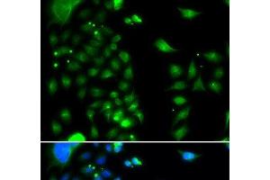 Immunofluorescence analysis of MCF-7 cells using UBE2J2 Polyclonal Antibody (UBE2J2 anticorps)