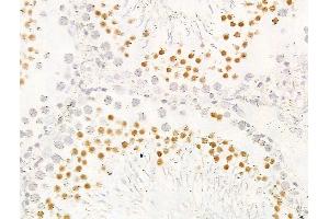 ABIN7094792 and ABIN7098843 at 1/100 staining Rat testis tissue by IHC-P. (KDM5C anticorps  (C-Term))