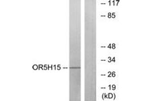 Western blot analysis of extracts from COLO cells, using OR5H15 Antibody. (OR5H15 anticorps  (AA 241-290))
