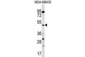 Western Blotting (WB) image for anti-Sorting Nexin 4 (SNX4) antibody (ABIN2996990) (Sorting Nexin 4 anticorps)