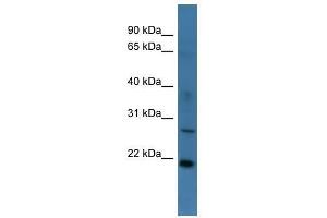 Western Blot showing STARD4 antibody used at a concentration of 1-2 ug/ml to detect its target protein. (STARD4 anticorps  (Middle Region))