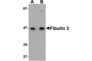 Western Blotting (WB) image for anti-Fibulin 3 (FBLN3) (C-Term) antibody (ABIN1030395) (FBLN3 anticorps  (C-Term))