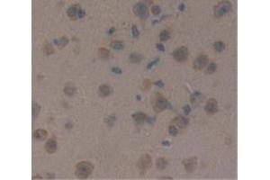 IHC-P analysis of Mouse Tissue, with DAB staining. (CRH anticorps  (AA 28-160))