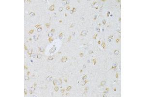 Immunohistochemistry of paraffin-embedded rat brain using NTS antibody (ABIN5998396) at dilution of 1/100 (40x lens). (Neurotensin anticorps)