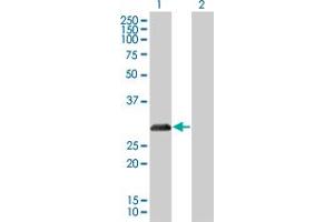Lane 1: CDKN1B transfected lysate ( 22. (CDKN1B 293T Cell Transient Overexpression Lysate(Denatured))