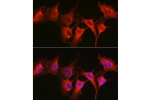 Immunofluorescence analysis of C6 cells using HSP70/HSP Rabbit pAb  at dilution of 1:250 (40x lens).