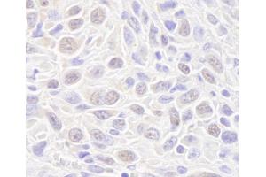 Immunohistochemistry (IHC) image for anti-RAD50 Homolog (S. Cerevisiae) (RAD50) (AA 700-750) antibody (ABIN7448751) (RAD50 anticorps  (AA 700-750))