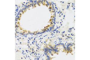 Immunohistochemistry of paraffin-embedded rat lung using UVRAG antibody at dilution of 1:100 (x40 lens). (UVRAG anticorps)