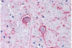 Anti-GABRA3 antibody  ABIN1048638 IHC staining of human brain, globus pallidus.