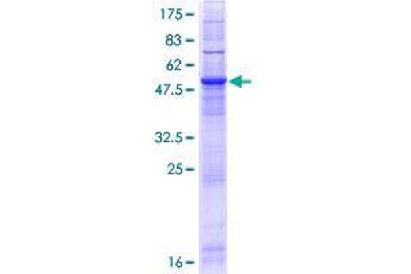 CLN6 Protein (AA 1-311) (GST tag)