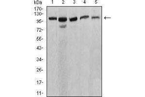 Western blot analysis using ATP2A1 mouse mAb against C2C12 (1), COS7 (2), Hela (3), K562 (4), and Jurkat (5) cell lysate.