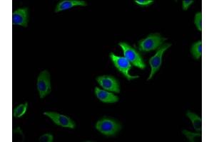Immunofluorescence staining of A549 cells with ABIN7172853 at 1:100, counter-stained with DAPI. (TRPM1 anticorps  (AA 1-97))