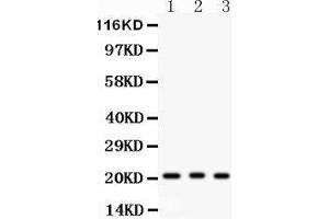 Anti- MGMT Picoband antibody, Western blotting All lanes: Anti MGMT  at 0. (MGMT anticorps  (AA 2-207))