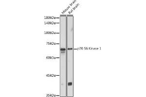 Western blot analysis of extracts of various cell lines, using p70 S6 Kinase 1 1 antibody (ABIN7270029) at 1:1000 dilution.