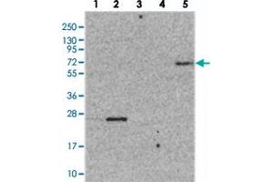 Western blot analysis of Lane 1: RT-4, Lane 2: U-251 MG, Lane 3: Human Plasma, Lane 4: Liver, Lane 5: Tonsil with ZNF623 polyclonal antibody  at 1:250-1:500 dilution. (ZNF623 anticorps)