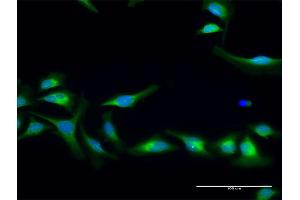 Immunofluorescence of purified MaxPab antibody to PLOD2 on HeLa cell. (PLOD2 anticorps  (AA 1-758))