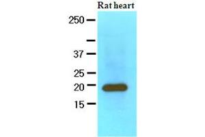 The extracts of Rat heart (60ug) were resolved by SDS-PAGE, transferred to NC membrane and probed with anti-human MYL2 (1:1000).