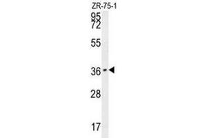 CLEC12A Antibody (Center) western blot analysis in ZR-75-1 cell line lysates (35µg/lane).